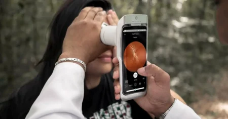 Campinas passa a oferecer, de forma inédita no SUS municipal, exame de retina com uso de IA
